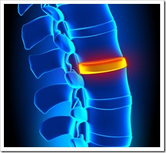 Herniated Disc and Back Pain Oak Park IL