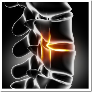 Slipped Disc Oak Park IL